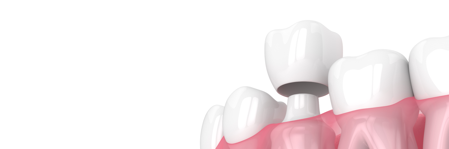 3D Rendering einer Zahnkrone